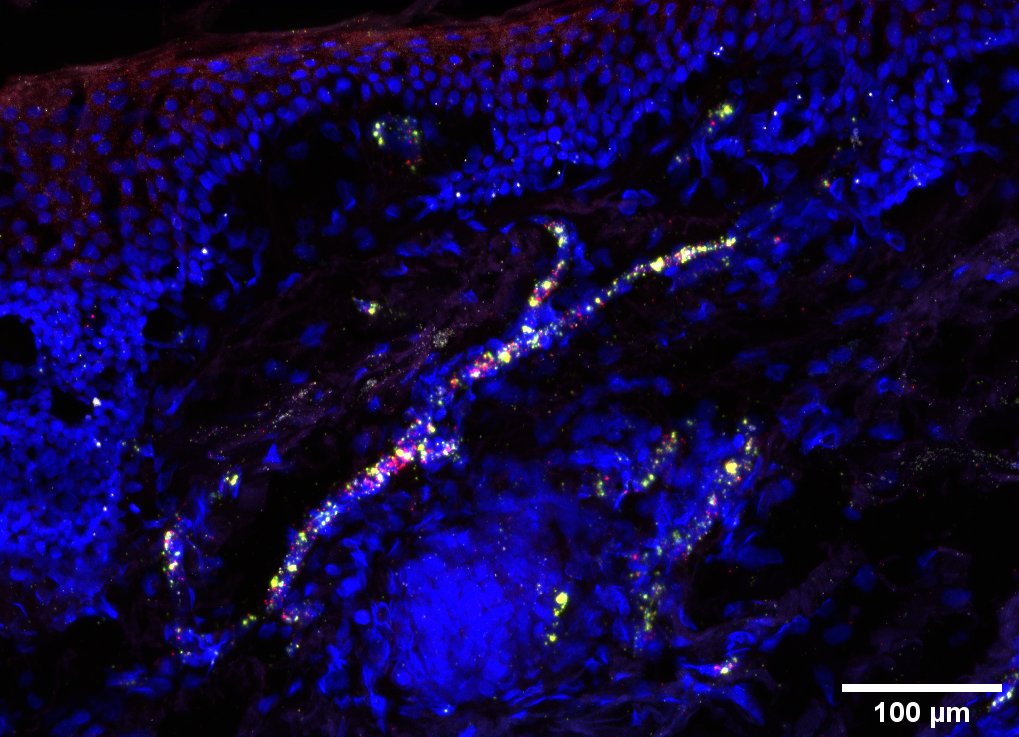 AI analysis of Optical Coherence Tomography scans