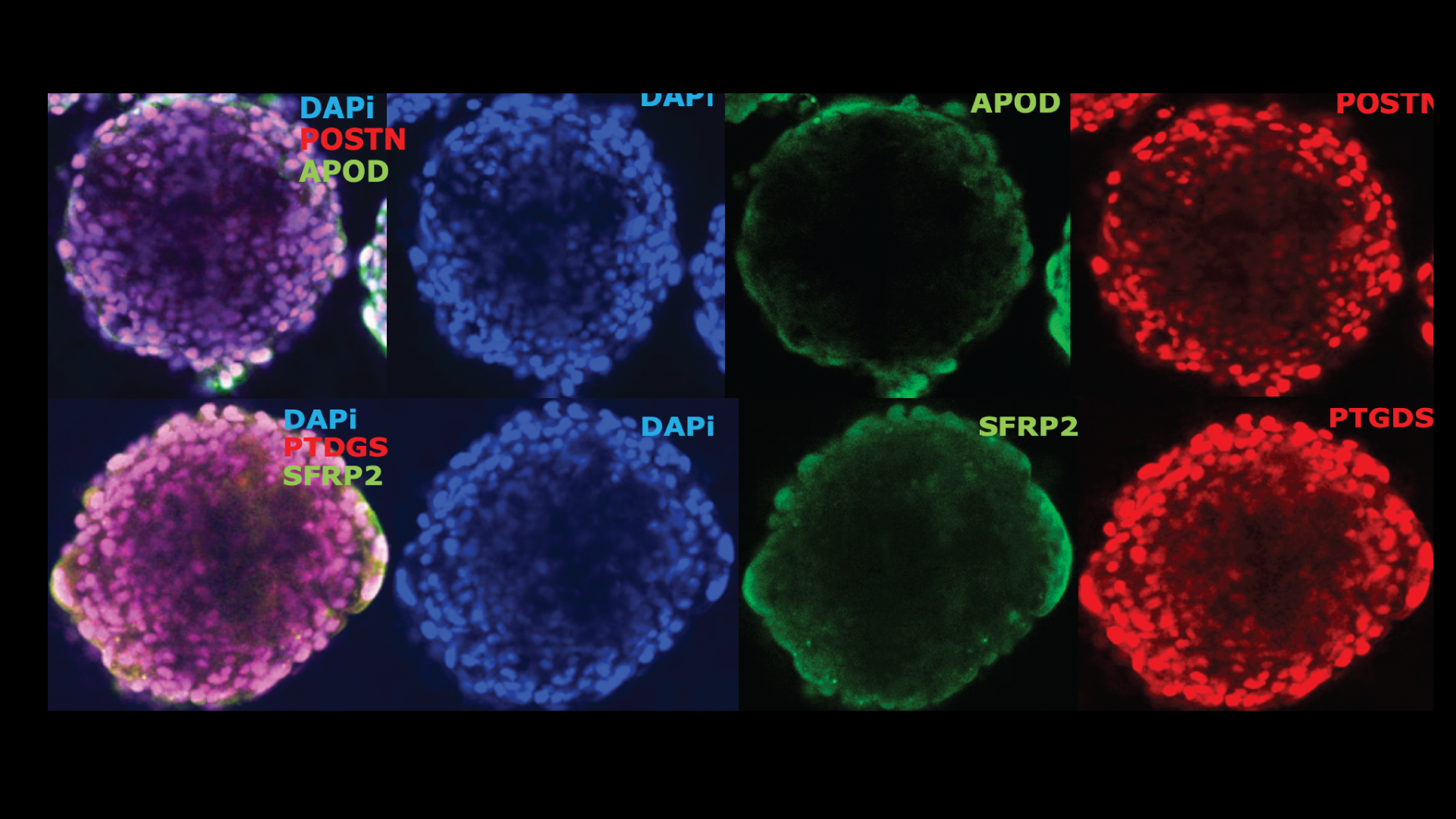 Senescence mapping in human skin